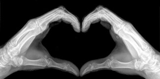 Una questione di cuore